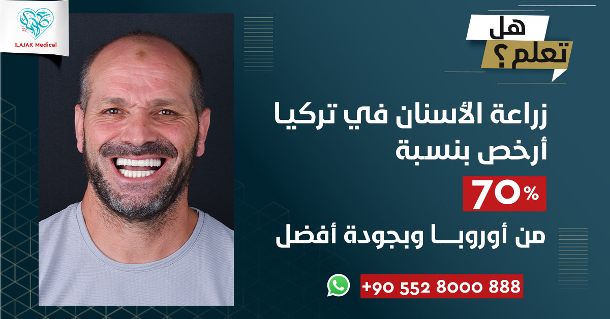 زراعة الأسنان ارخص 70%