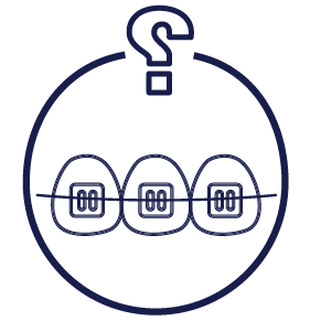 أسئلة شائعة عن تقويم الأسنان المعدني