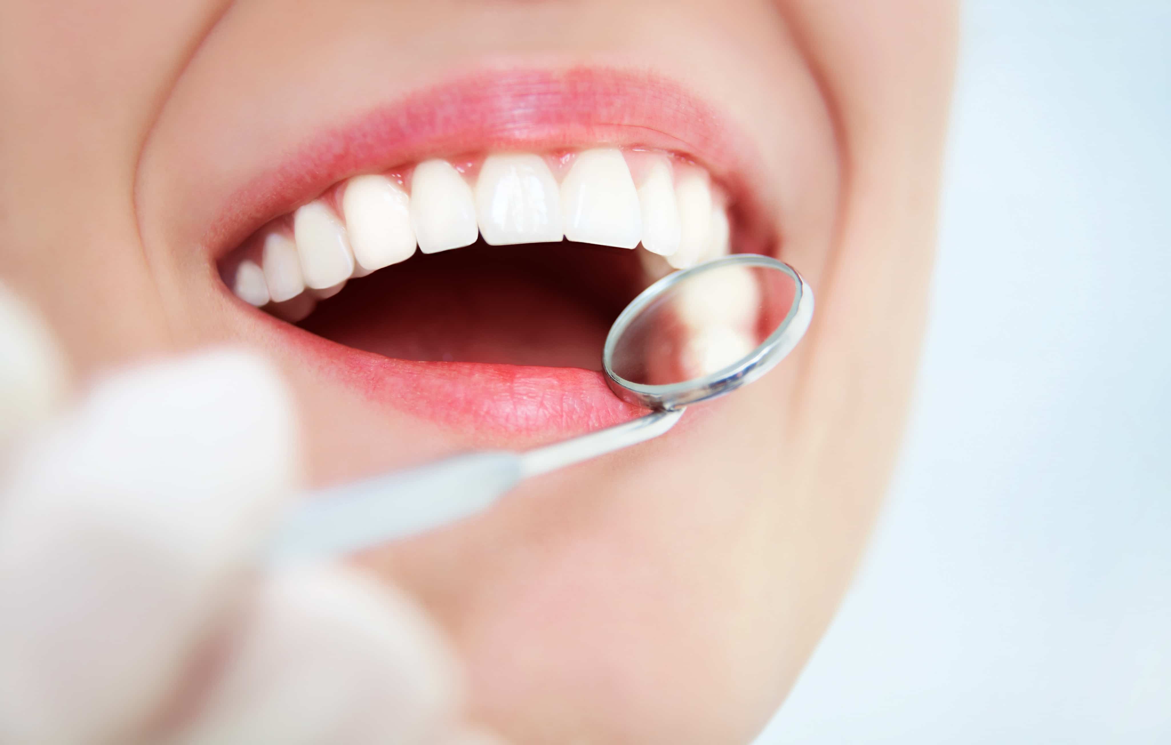 الأسئلة الشائعة عن تقويم الأسنان