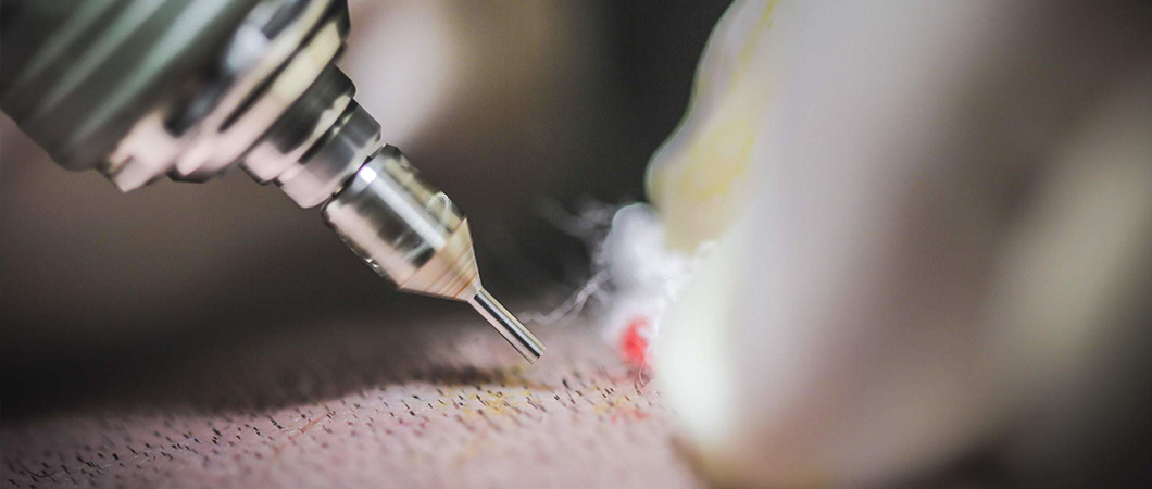 What is DHI Hair Transplant and its cost in Turkey? | علاجك الطبية What is DHI Hair Transplant and its cost in Turkey? | علاجك الطبية