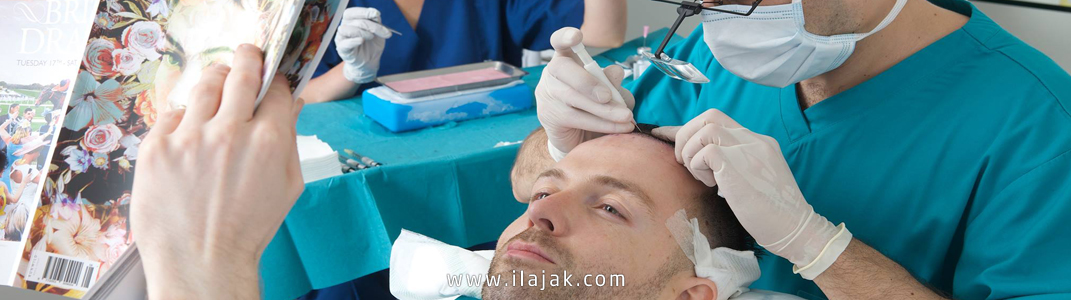 تقنيات و تكاليف زراعة الشعر في تركيا 2021 تكاليف زراعة الشعر في تركيا الأرخص والأفضل 2021