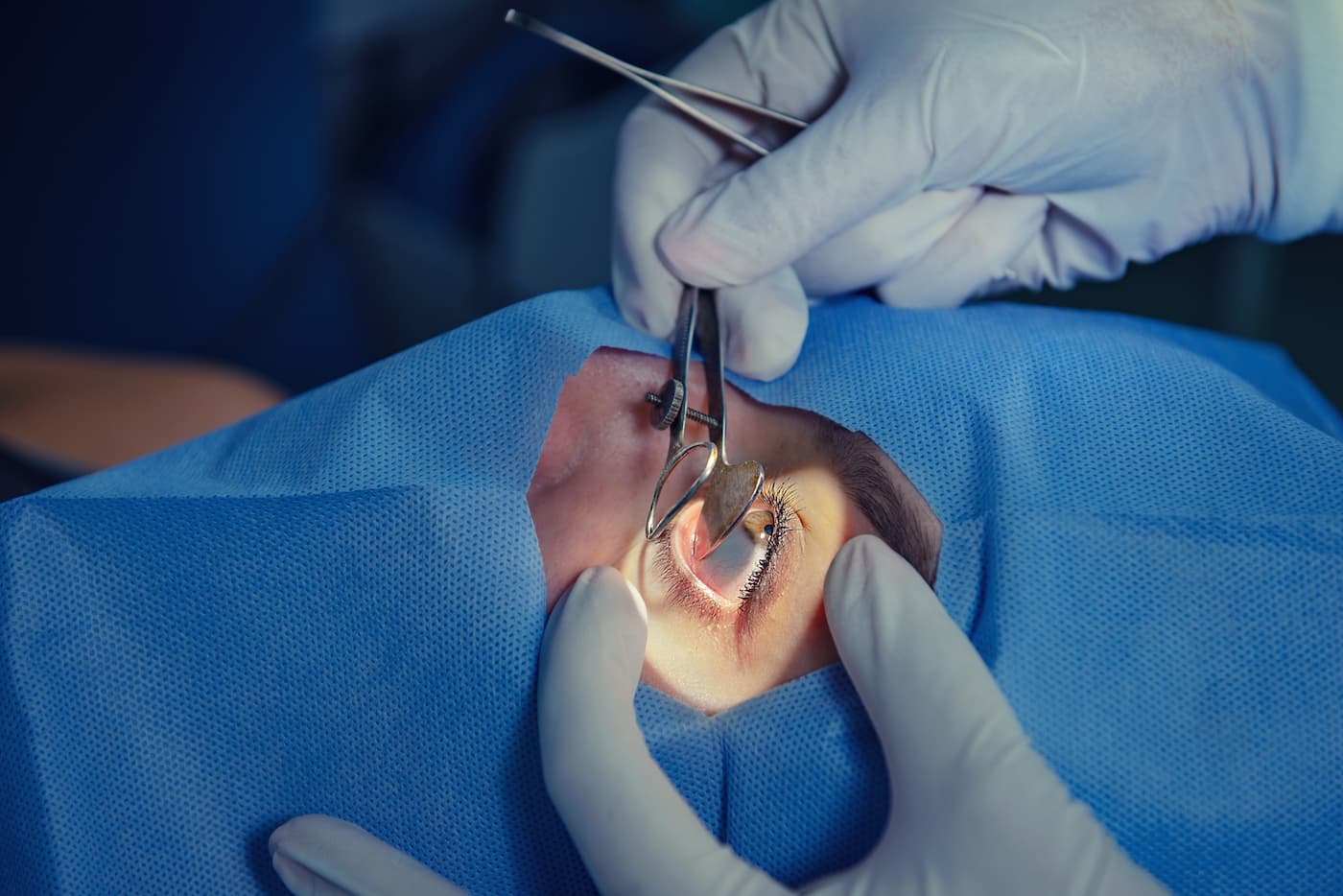 هل طب العيون في تركيا قوي , وماهي تكاليفها ؟ طب و جراحة العيون في تركيا وتكاليفها