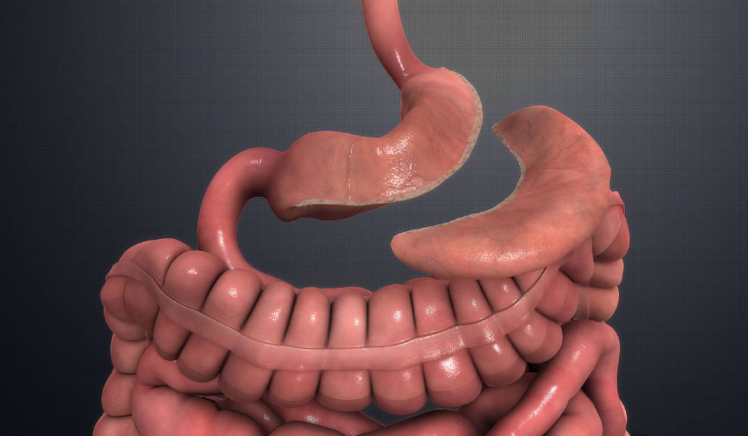 عملية تدبيس المعدة و مقارنتها بعملية تكميم المعدة علاجك الطبية