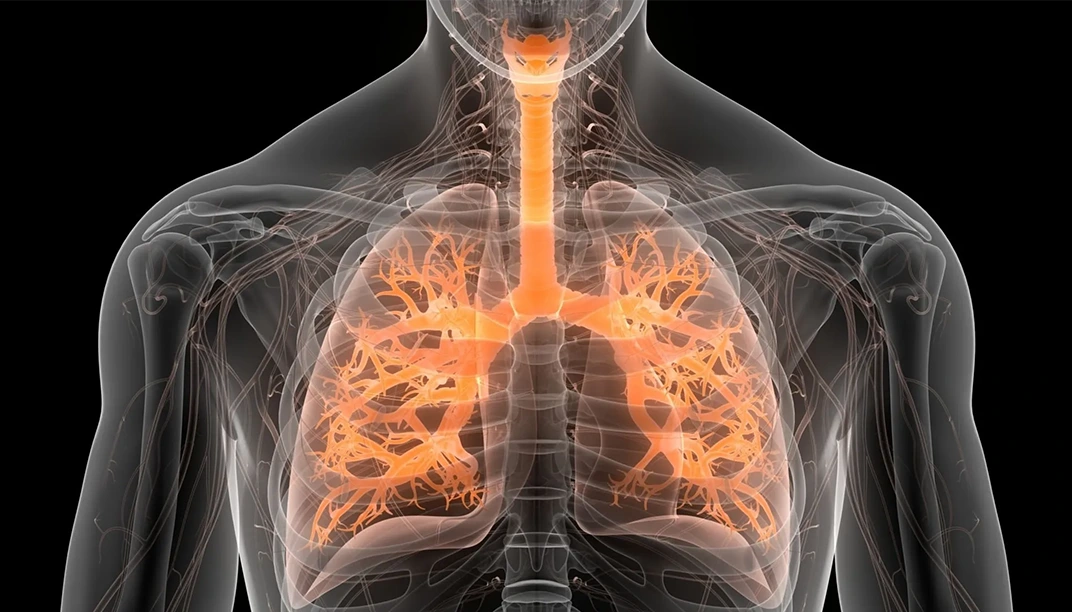 أشهر 10 أمراض تصيب الجهاز التنفسي وكيفية الوقاية | علاجك الطبية