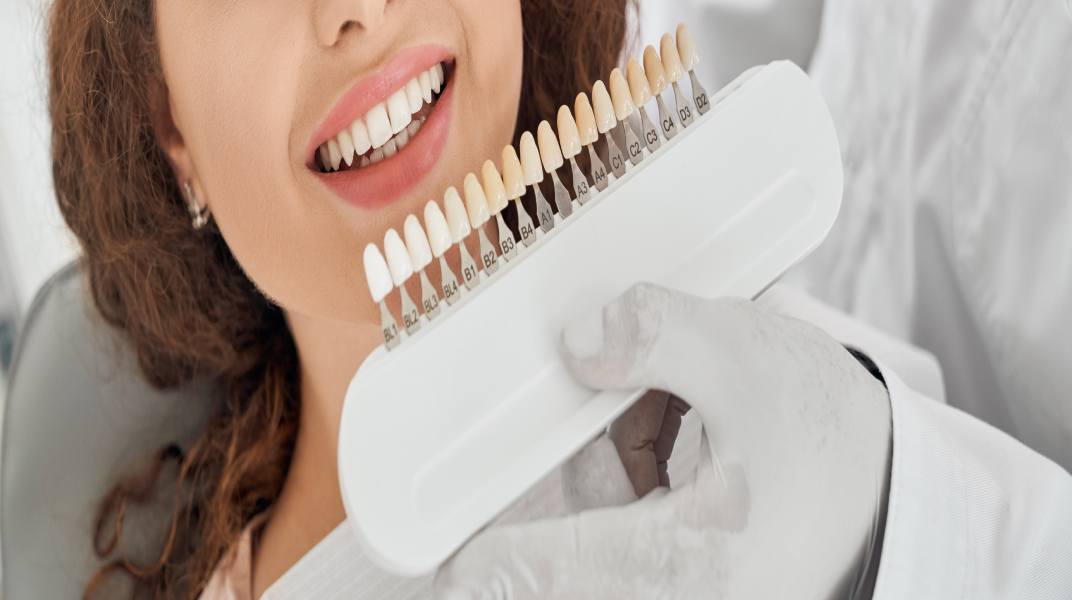 Veneers vs Lumineers Similarities and Differences ILAJAK Medical