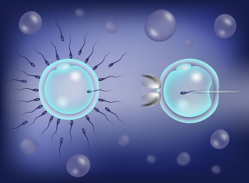 IVF Vs ICSI Which Is Better For Infertility Treatment ILAJAK Medical