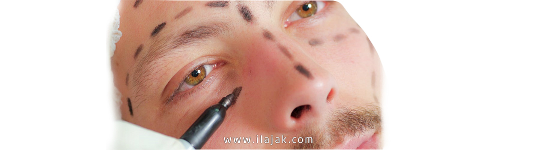 جراحة تجميل الأنف في تركيا 2021– المميزات والأسعار جراحة الأنف في تركيا – المزايا والأسعار