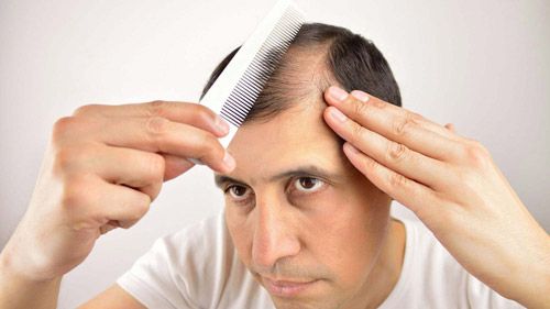 ما هي أنواع تساقط الشعر الشائعة؟ | علاجك الطبية