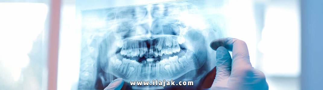 نصائح لصحة الفم وعلاج الأسنان في زمن كورونا علاج الأسنان في زمن كورونا .. نصائح وإرشادات