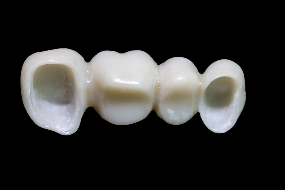 الأسنان البورسلين – مميزاتها ومخاطرها وتكاليفها | علاجك الطبية