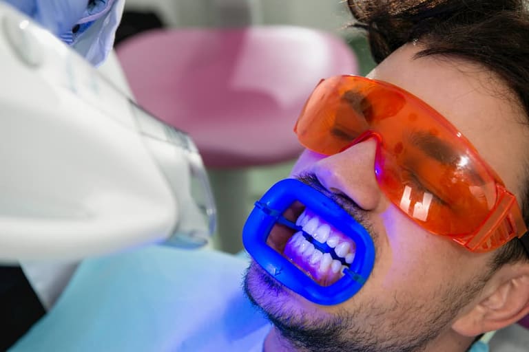 كيف يتم تبييض الأسنان بالليزر ؟ وتكاليفه في تركيا | علاجك الطبية