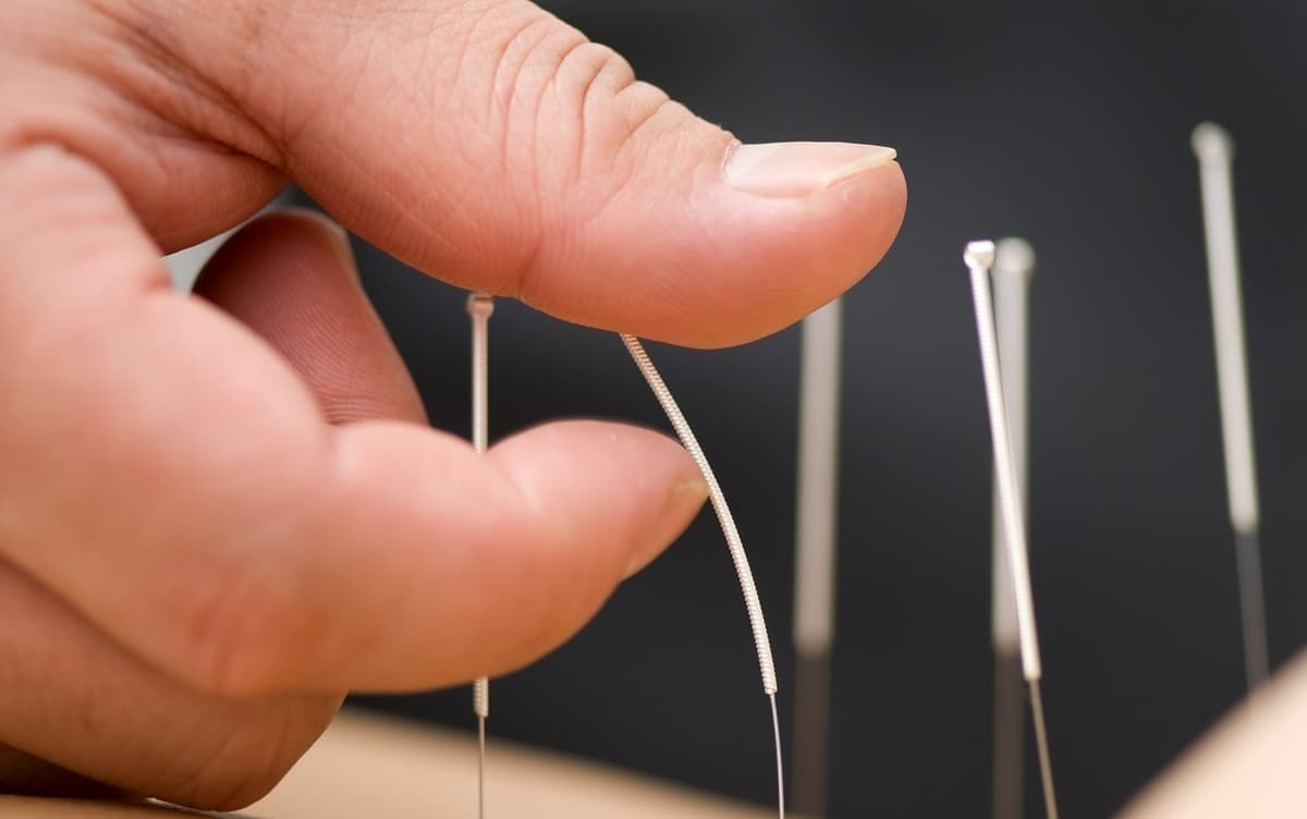 Eczema et Acupuncture chinoise