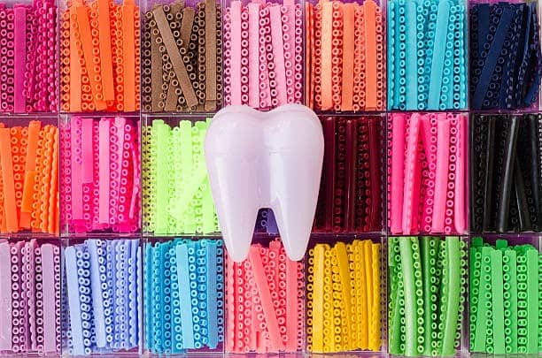 ألوان تقويم الأسنان