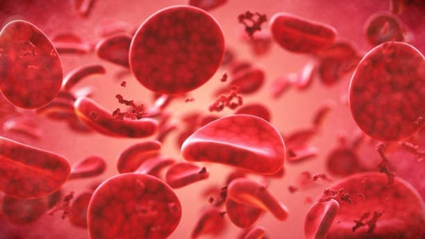 فقر الدم - أعراض فقر الدم