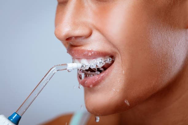 جهاز تنظيف الاسنان بالماء