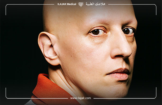 الثعلبة الشاملة - علامات الشفاء من الثعلبة