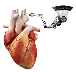 جراحات القلب بالروبوت