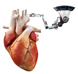 Robotic Heart Surgery