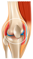 Hip and knee joint surgeries