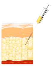 Liposuction in Turkey Liposuction