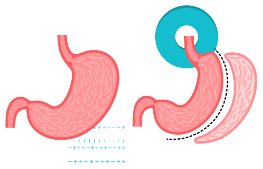 Bariatrics